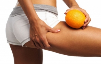 Nem betegség a narancsbőr