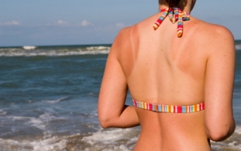 Napégésre házilag